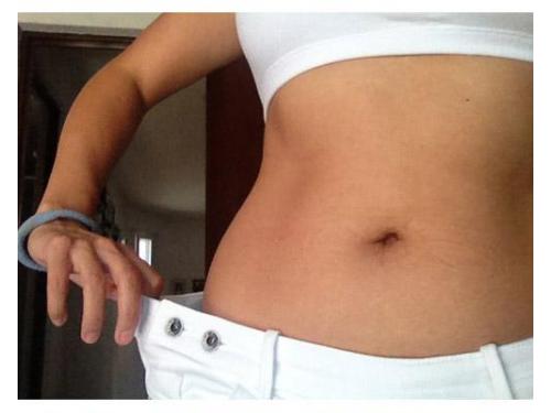 Final de tratamiento