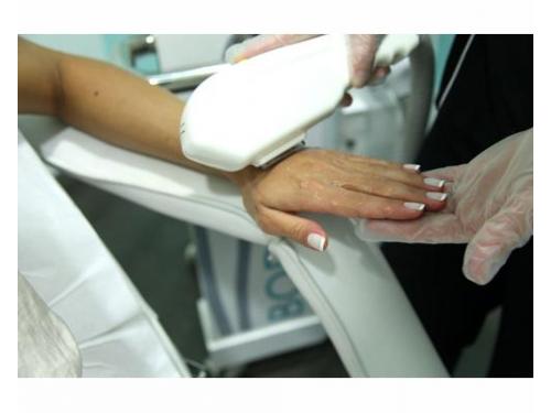 Tratamiento de rejuvenecimiento manos