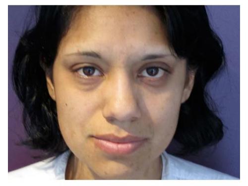 Entrando a la estética