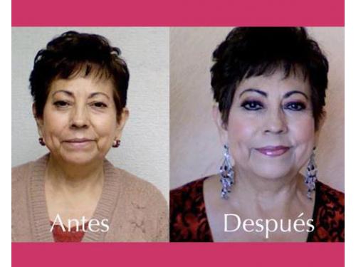 Difumina  imperfecciones