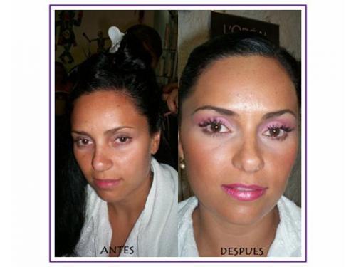 Antes - después