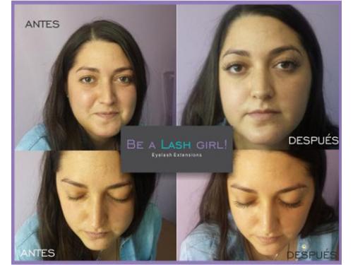 Tratamientos de belleza