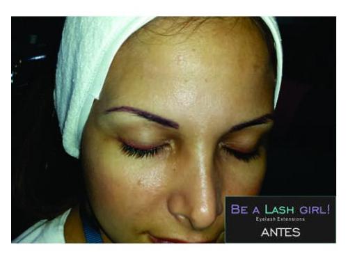 Tratamientos de belleza