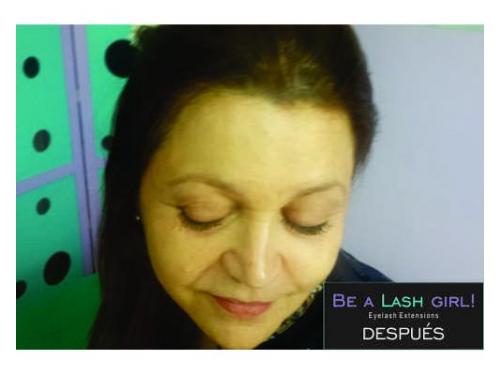 Tratamientos profesionales