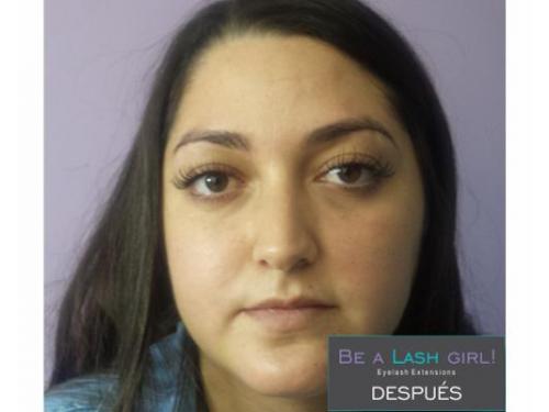 Tratamientos profesionales