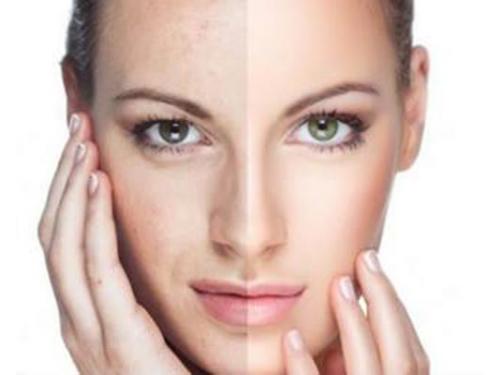 Plasma con plaquetas