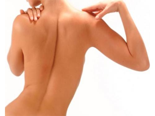 Lipoescultura sin cirugías