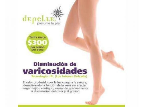 Disminución de varicosidades