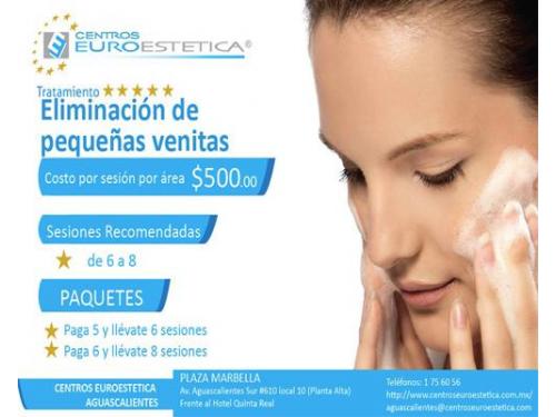 Paquete eliminación   de venitas