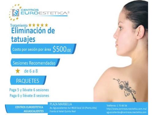 Paquete eliminación  de tatuajes