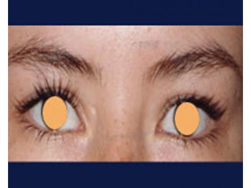 Delineado permanente; antes