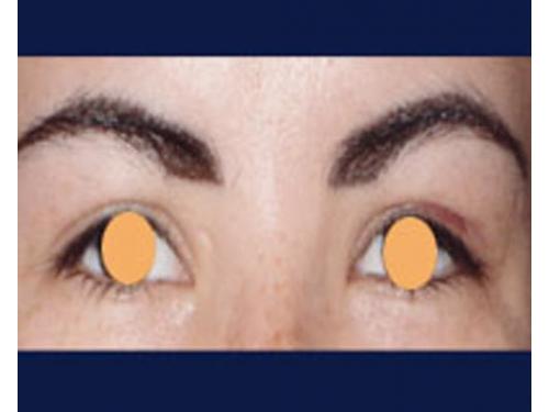 Delineado permanente; después