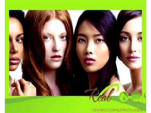 Fotorejuvenecimiento con microdermoabrasión y radiofrecuencia