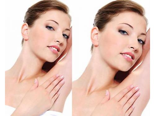 Depilación definitiva, facial y corporal