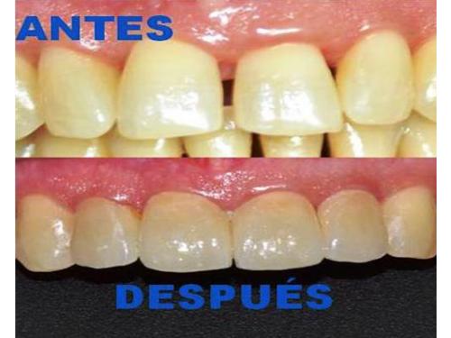 Antes y después