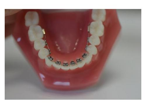 Tratamientos para tu sonrisa