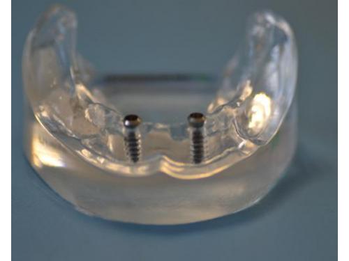 Tratamientos para tu sonrisa