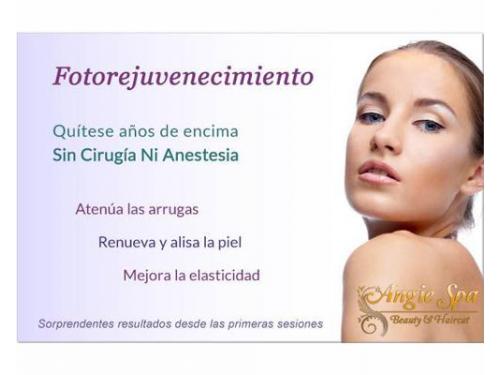 Fotorejuvenecimiento