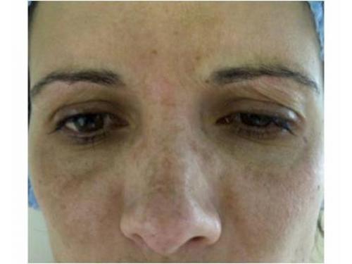 Después cejas y ojos