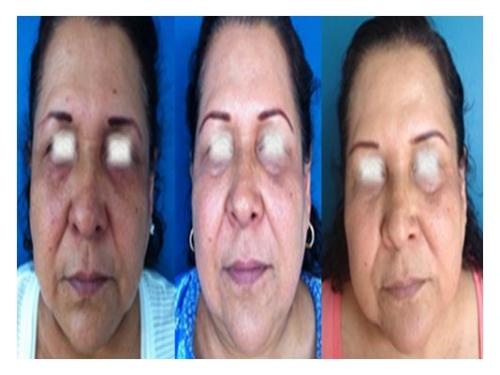 Tratamientos de belleza