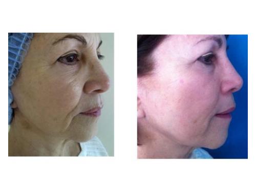 Luce una piel perfecta