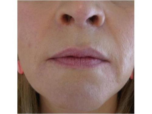 Expertos en tratamientos faciales