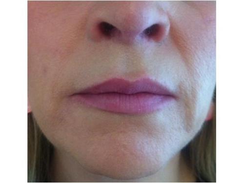 Expertos en tratamientos faciales